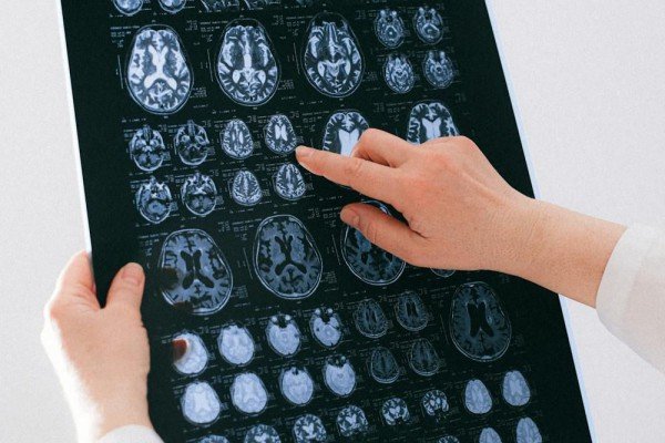 Lima Fakta Menarik Tentang Otak Berkembang Seumur Hidup